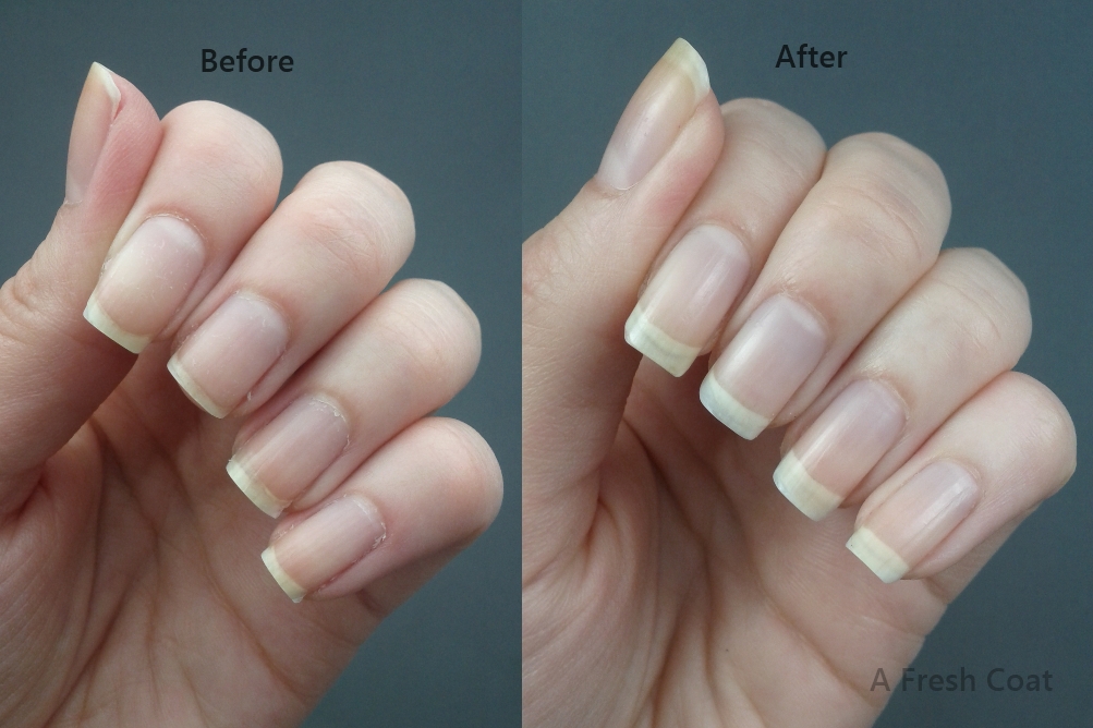 Duri Rejuvacote Before & After